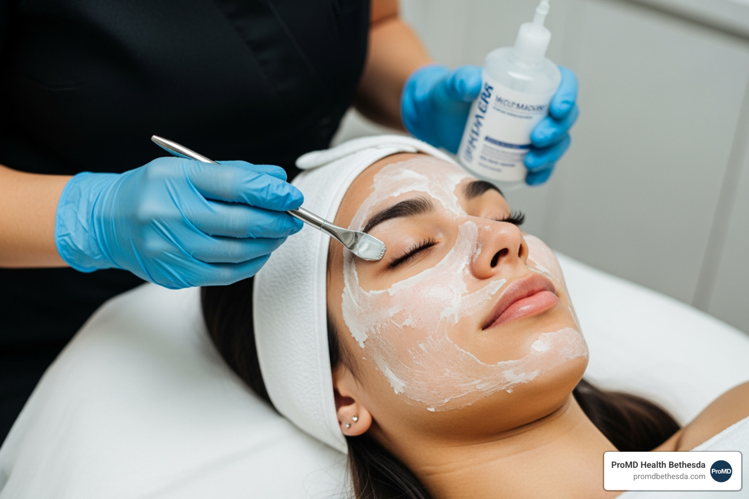 how do chemical peels work
